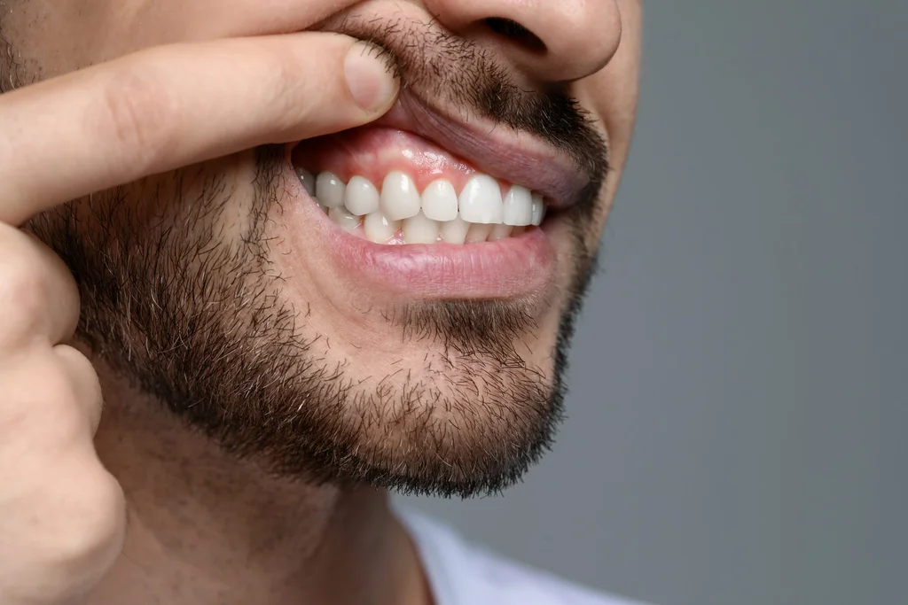 Early Signs of Gum Disease to Watch for This Spring